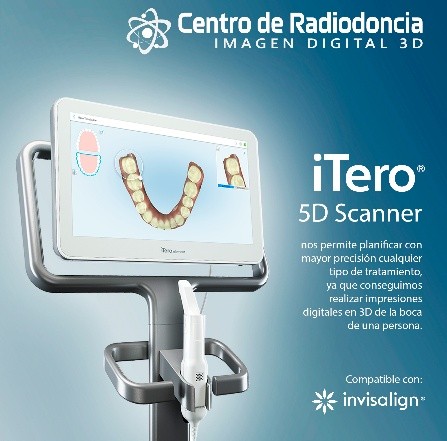 Escáner Intraoral Itero Element
