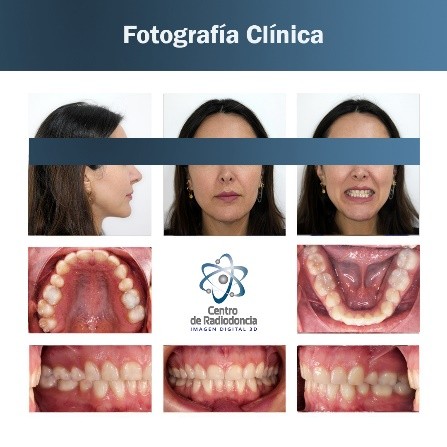 Fotografía Clínica