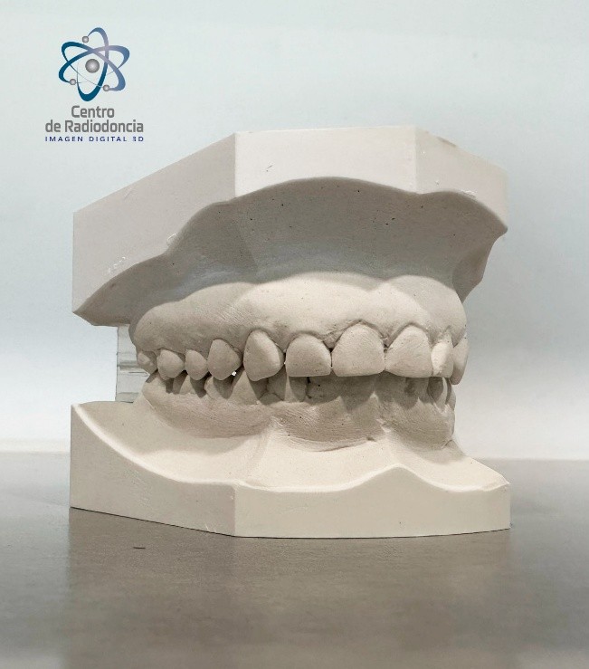 Modelos Digitales Dentales