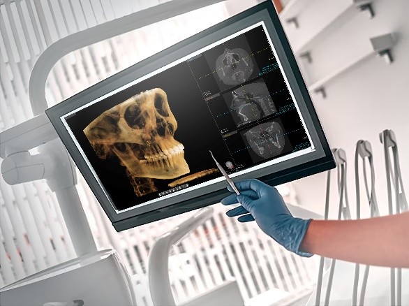 Tomografía Computarizada 3D